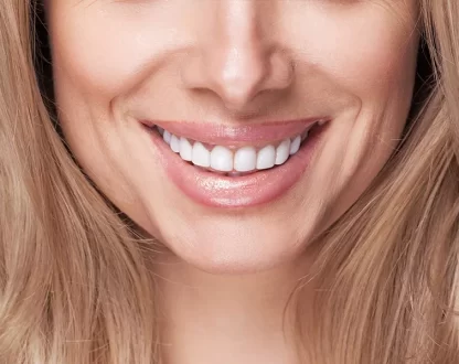 The Best Aftercare Tips for Long-Lasting Teeth Whitening Results