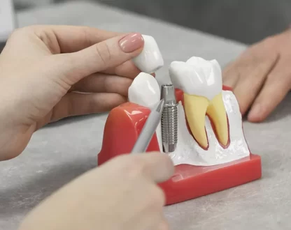 Understanding the Dental Implant Healing Stages for a Smooth Recovery